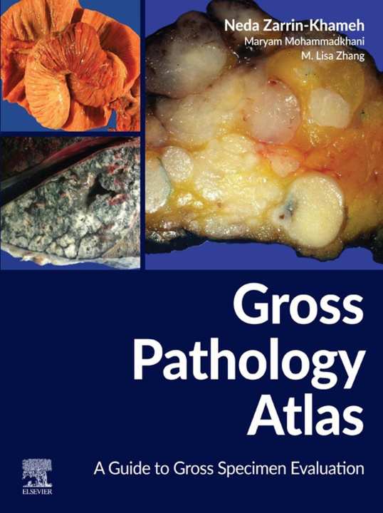 E-knjiga Gross Pathology Atlas Neda Zarrin-Khameh