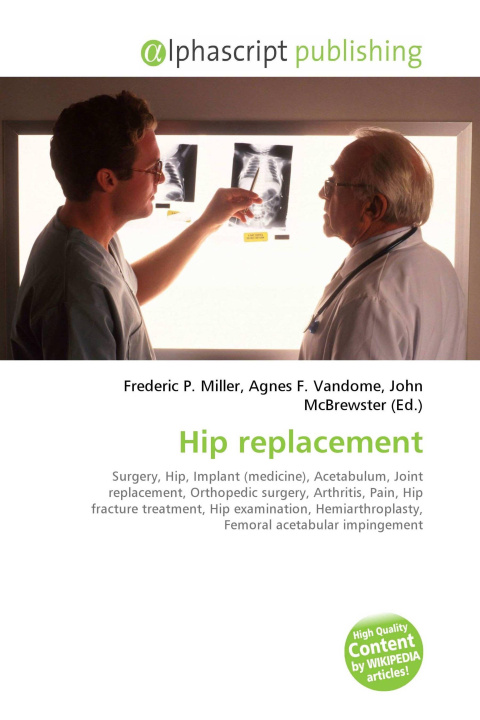 Kniha Hip replacement Agnes F. Vandome