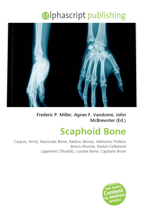 Kniha Scaphoid Bone Agnes F. Vandome