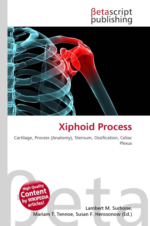 Könyv Xiphoid Process Miriam T. Timpledon