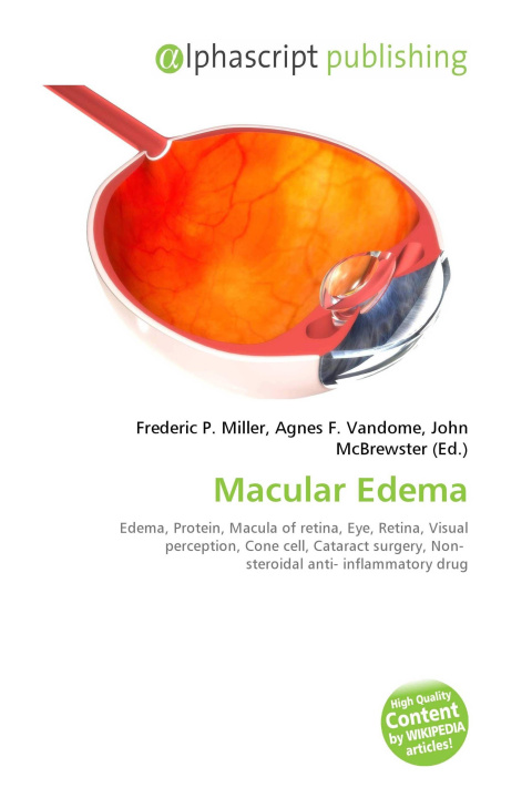 Könyv Macular Edema Agnes F. Vandome