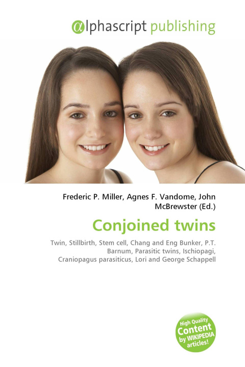 Kniha Conjoined twins Agnes F. Vandome
