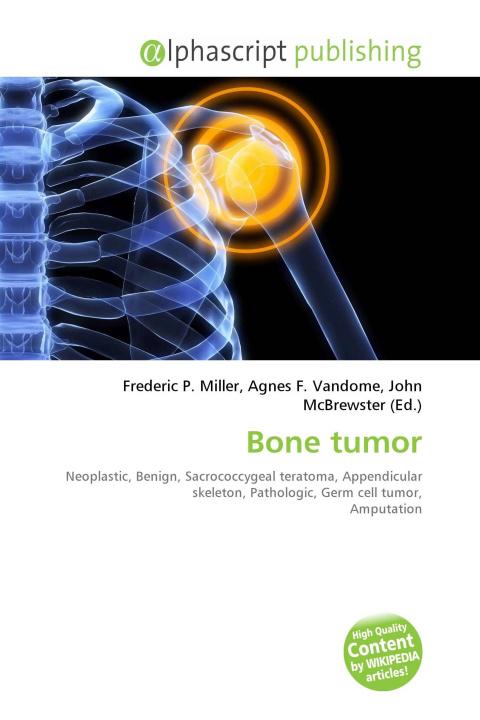 Kniha Bone tumor Agnes F. Vandome