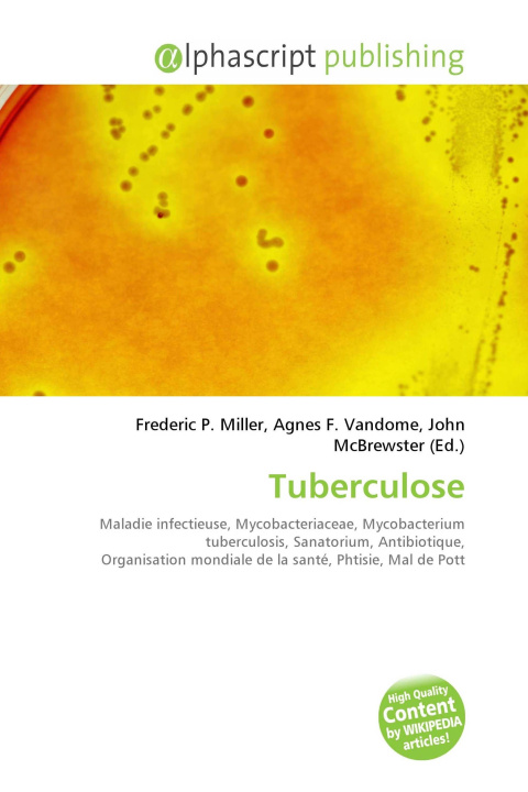 Kniha Tuberculose Agnes F. Vandome