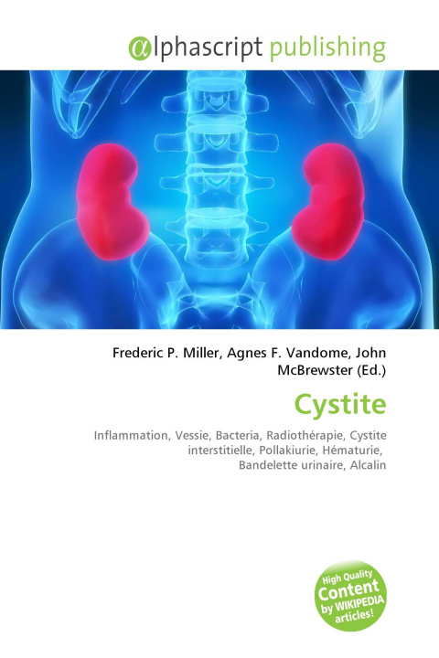 Knjiga Cystite Agnes F. Vandome