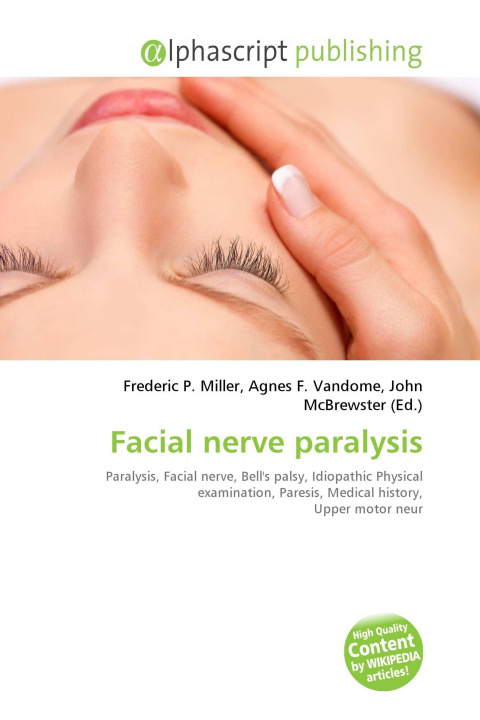 Kniha Facial nerve paralysis Agnes F. Vandome