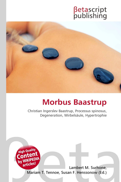 Kniha Morbus Baastrup Mariam T. Tennoe
