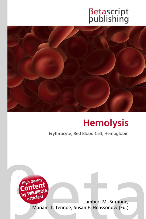 Kniha Hemolysis Mariam T. Tennoe