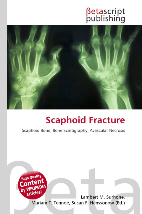 Kniha Scaphoid Fracture Mariam T. Tennoe