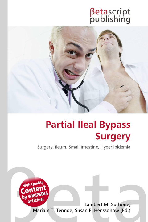 Kniha Partial Ileal Bypass Surgery Mariam T. Tennoe