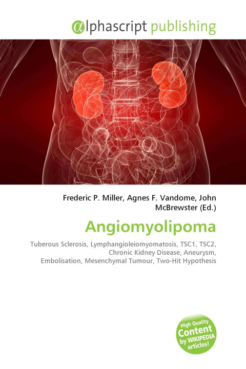 Kniha Angiomyolipoma Agnes F. Vandome