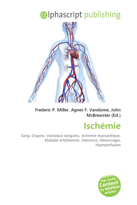 Knjiga Ischémie Agnes F. Vandome