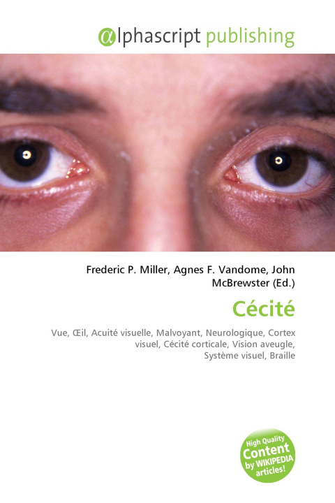 Kniha Cécité Agnes F. Vandome