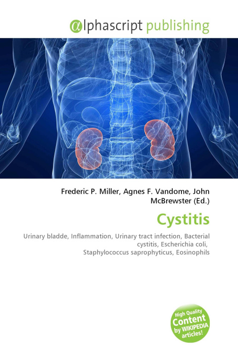 Kniha Cystitis Agnes F. Vandome