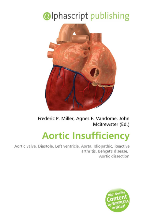 Kniha Aortic Insufficiency Agnes F. Vandome