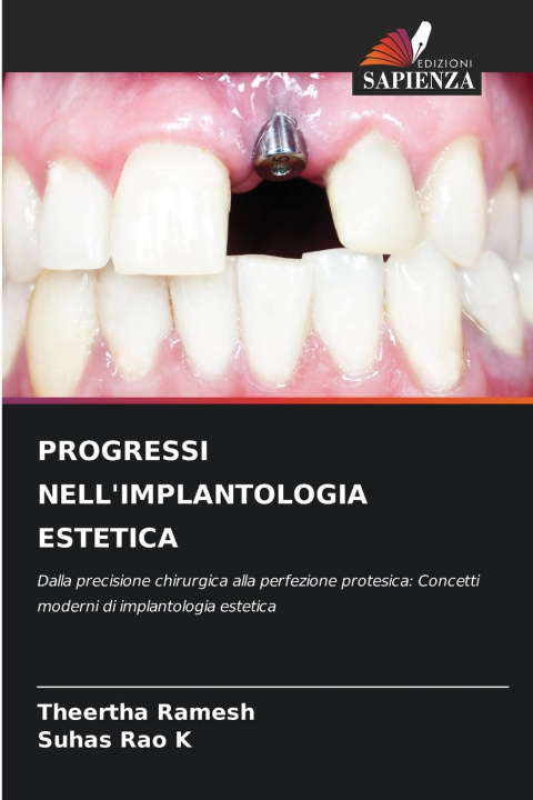 Kniha PROGRESSI NELL'IMPLANTOLOGIA ESTETICA Theertha Ramesh