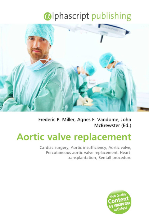 Kniha Aortic valve replacement Agnes F. Vandome