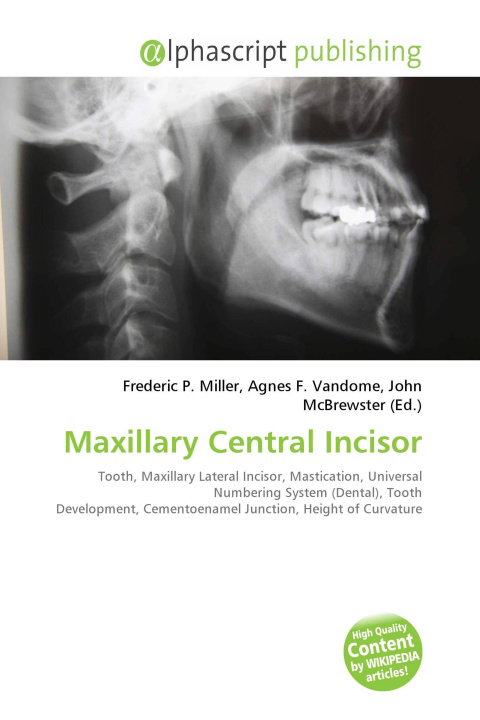 Kniha Maxillary Central Incisor Agnes F. Vandome