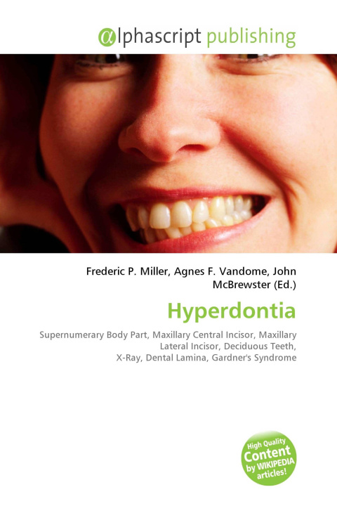 Book Hyperdontia Agnes F. Vandome