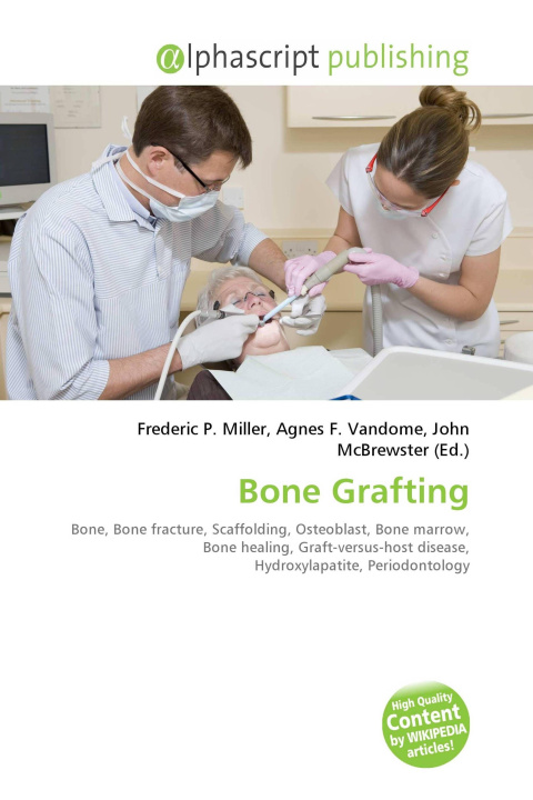 Kniha Bone Grafting Agnes F. Vandome