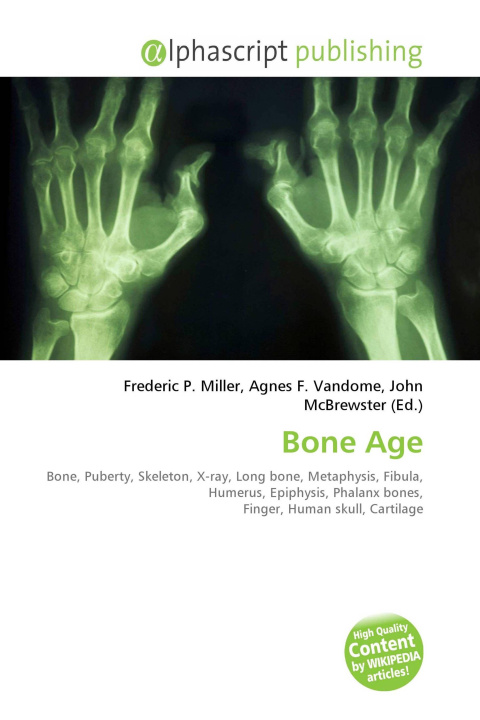 Kniha Bone Age Agnes F. Vandome