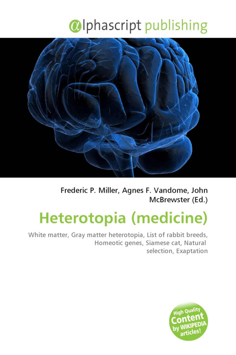Kniha Heterotopia (medicine) Agnes F. Vandome