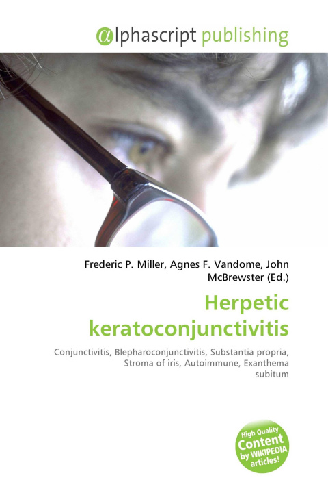 Kniha Herpetic keratoconjunctivitis Agnes F. Vandome