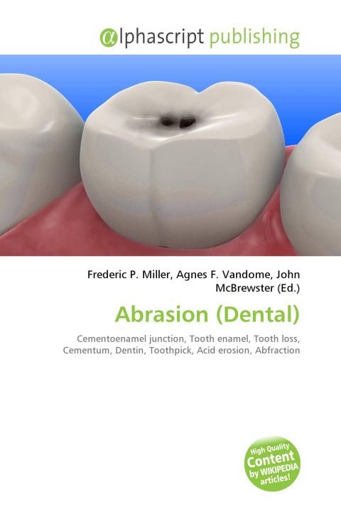 Book Abrasion (Dental) Agnes F. Vandome