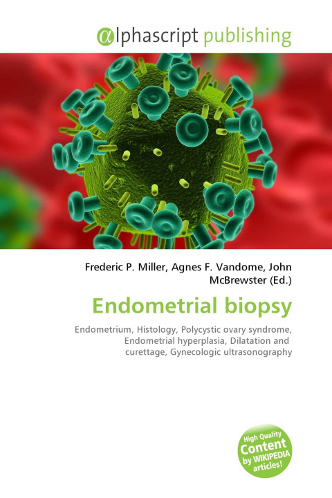 Kniha Endometrial biopsy Agnes F. Vandome