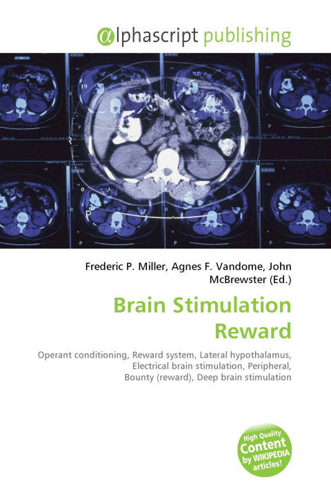 Книга Brain Stimulation Reward Agnes F. Vandome