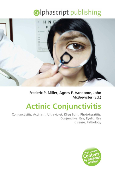 Kniha Actinic Conjunctivitis Agnes F. Vandome