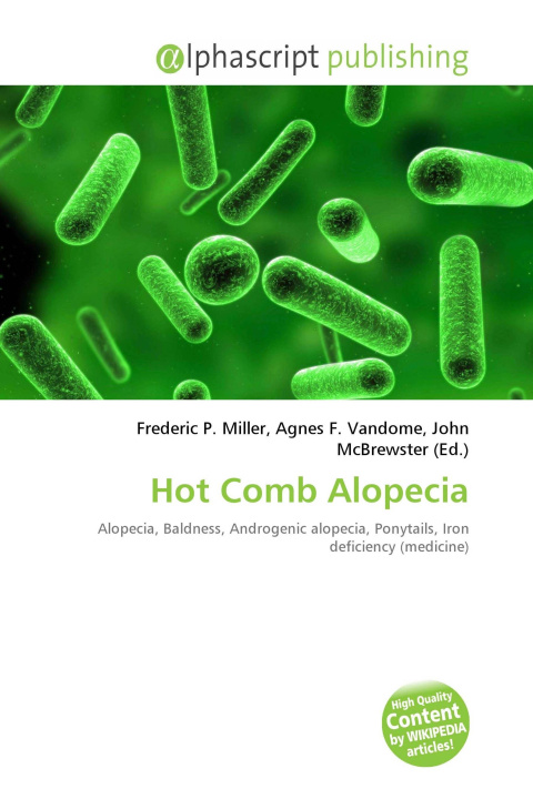 Kniha Hot Comb Alopecia Agnes F. Vandome