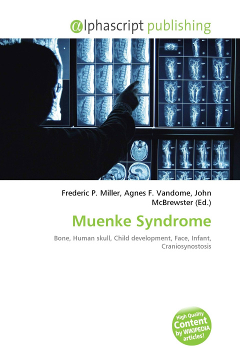 Книга Muenke Syndrome Agnes F. Vandome