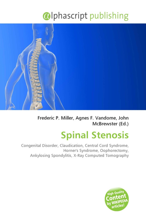 Knjiga Spinal Stenosis Agnes F. Vandome