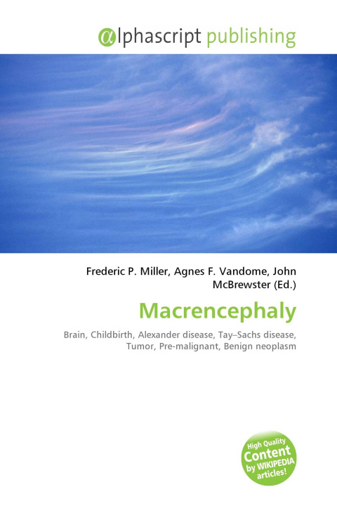 Knjiga Macrencephaly Agnes F. Vandome