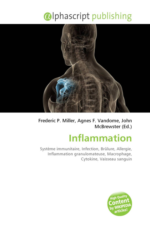 Kniha Inflammation Agnes F. Vandome