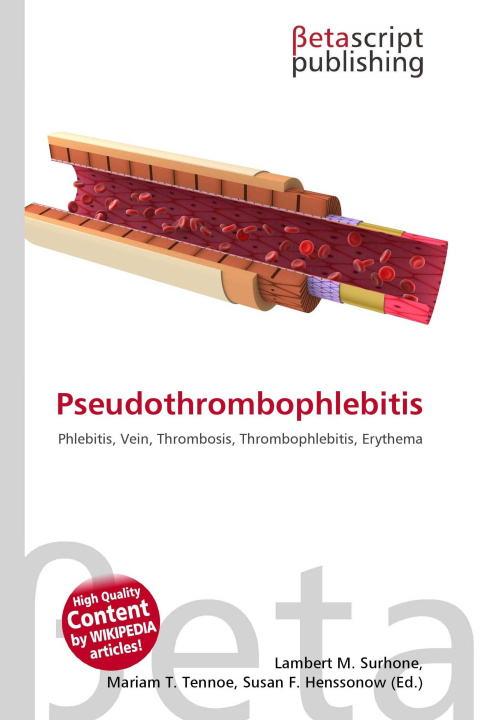 Kniha Pseudothrombophlebitis Mariam T. Tennoe