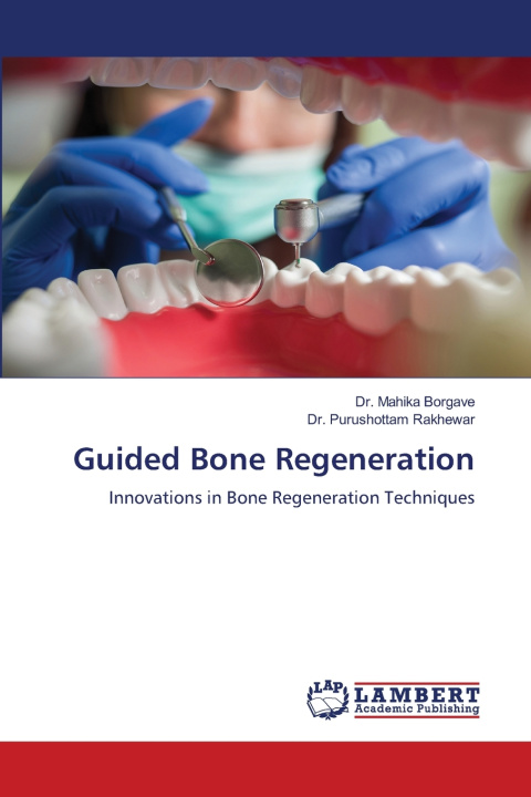 Kniha Guided Bone Regeneration Purushottam Rakhewar