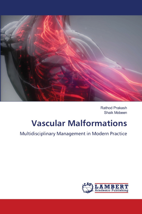 Knjiga Vascular Malformations Shaik Mobeen