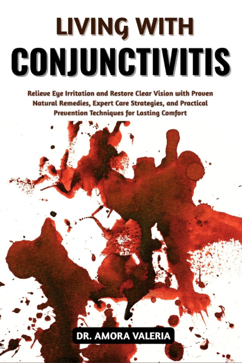 Knjiga Living With Conjunctivitis DR. AMORA VALERIA