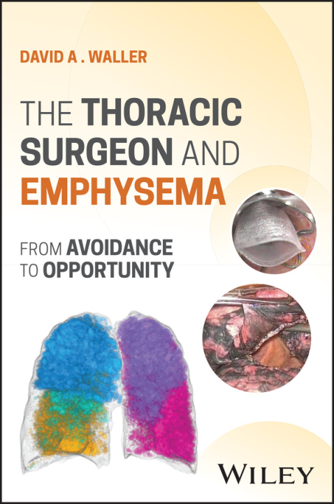Knjiga The Thoracic Surgeon and Emphysema: From avoidance  to opportunity DA Waller