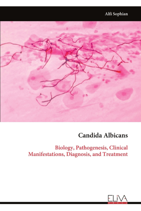 Kniha Candida Albicans Alfi Sophian
