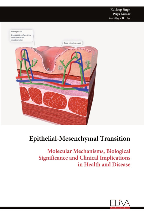 Kniha Epithelial-Mesenchymal Transition Kuldeep Singh