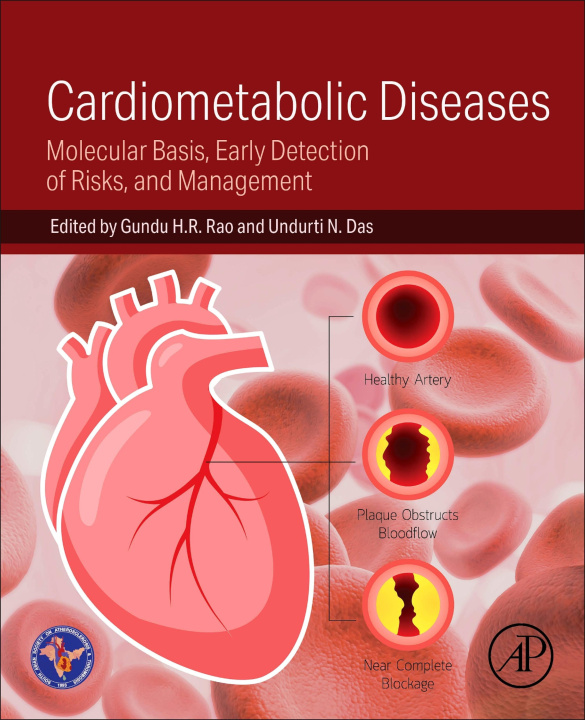 E-knjiga Cardiometabolic Diseases Gundu H. R. Rao
