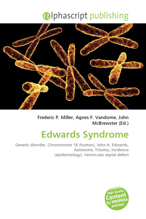Kniha Edwards Syndrome Agnes F. Vandome