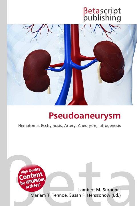 Kniha Pseudoaneurysm Mariam T. Tennoe
