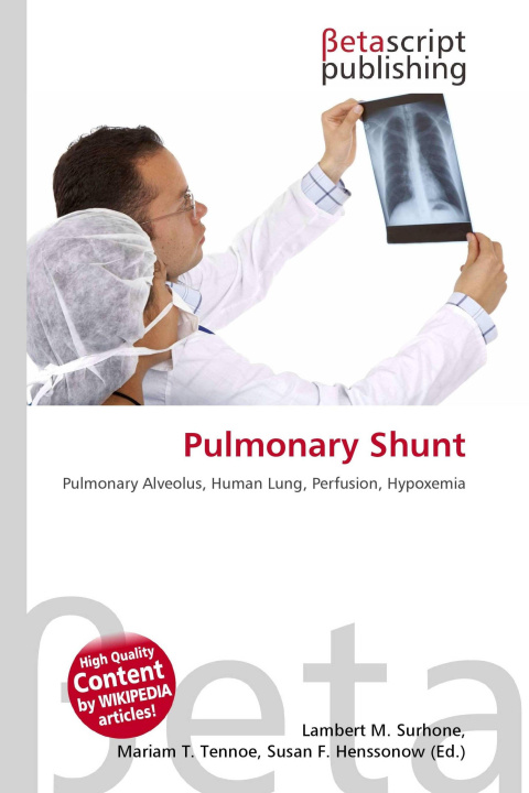 Kniha Pulmonary Shunt Mariam T. Tennoe