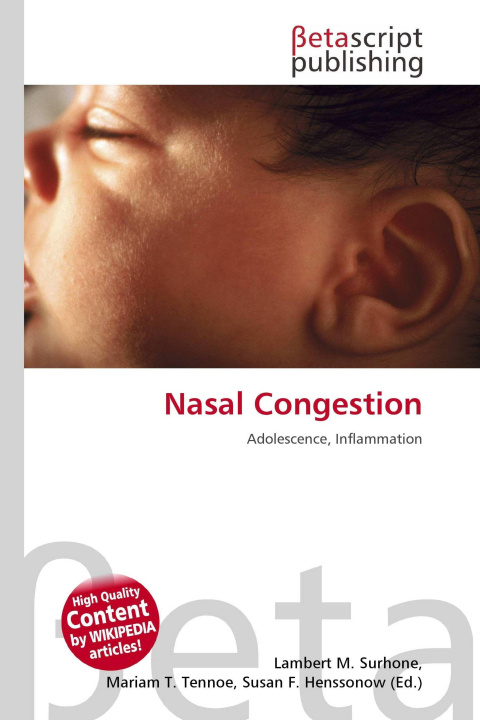 Kniha Nasal Congestion Mariam T. Tennoe
