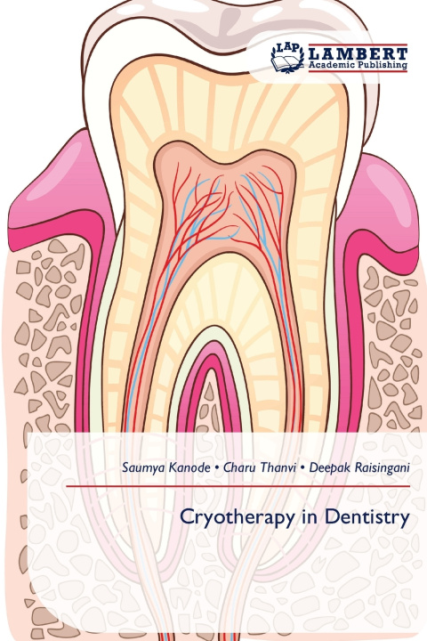 Kniha Cryotherapy in Dentistry Charu Thanvi