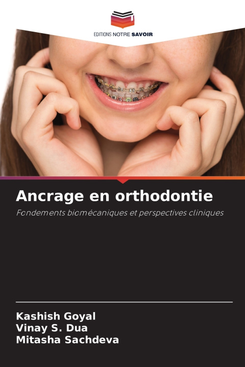 Carte Ancrage en orthodontie Kashish Goyal